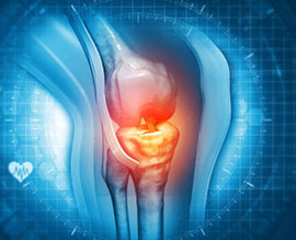 Orthopaediac
